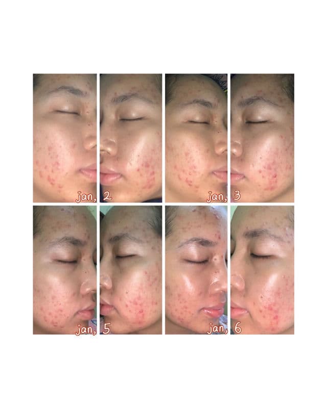 COMMONLABS Triple Vita Balancing Toner review photo by Siitha