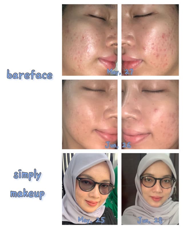 Real Barrier Cream Cleansing Foam review photo by Siitha