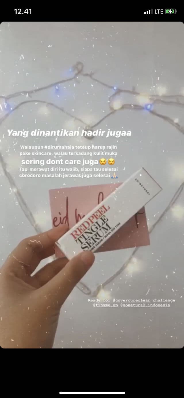 So Natural Red Peel Tingle Serum review photo by Siitha