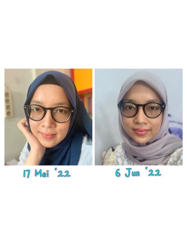 COMMONLABS Vitamin C Brightening Gel Cream review photo by Siitha