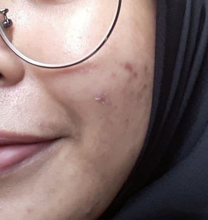 The Bright by Dayana Radzuan Brightening & Repairing Serum review photo by cikinlah