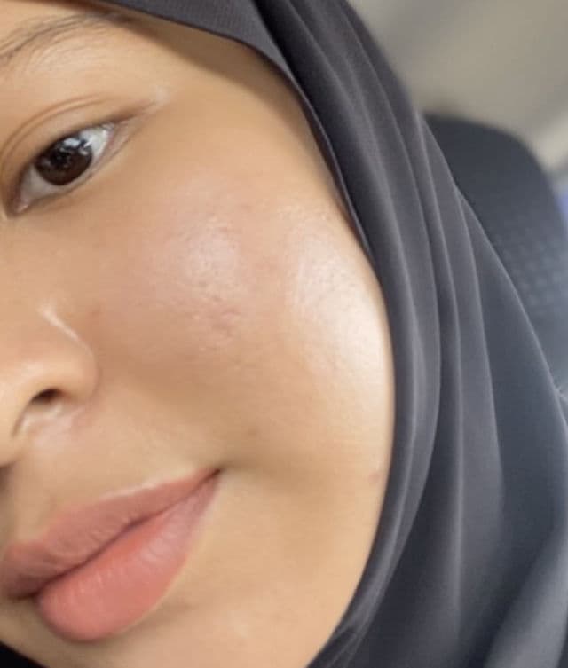 The Bright by Dayana Radzuan Brightening & Repairing Serum review photo by cikinlah
