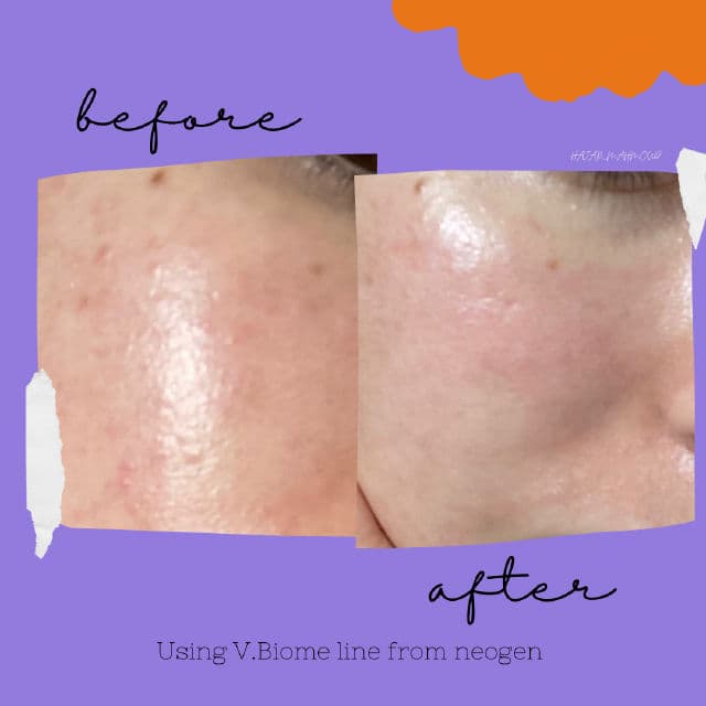 NEOGEN Dermalogy V.Biome Infusion Serum review photo by Hajarmahmoud