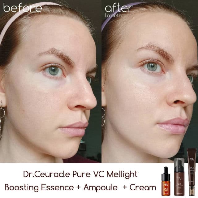 Pure VC Mellight Cream product review