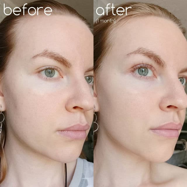 elmt Frameless Pure Vitamin C 20% Element review photo by TanyaKbeauty