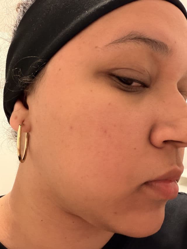 Caraseoul Protease Revitalizing Moisture Toner review photo by yoselaine