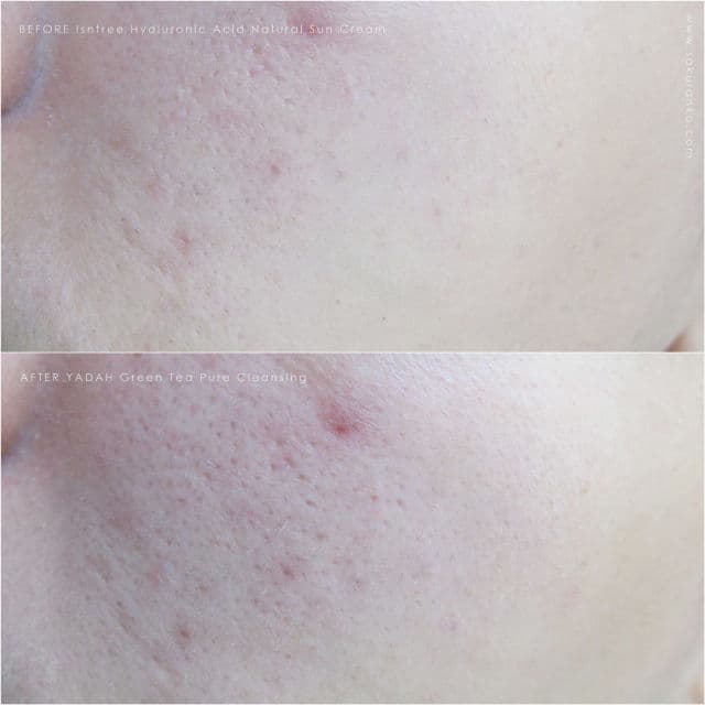 Yadah Green Tea Pure Cleansing Gel  review photo by Sakuranko