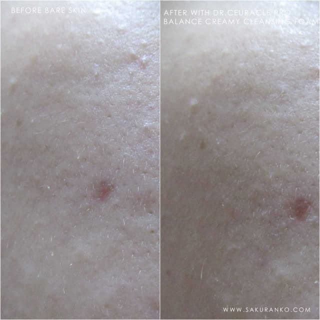 Dr. Ceuracle Pro Balance Creamy Cleansing Foam review photo by Sakuranko