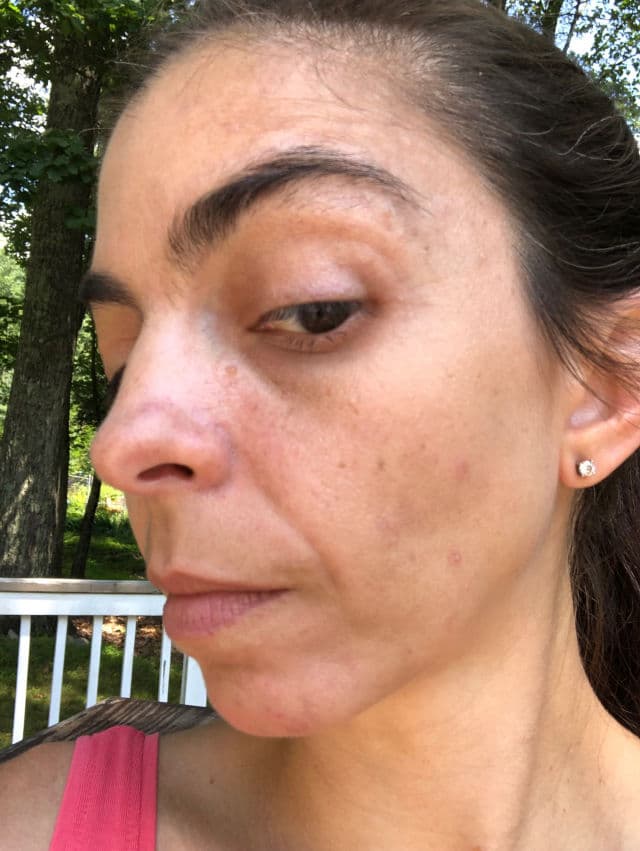 facetheory Lumizela Azelaic Acid Serum A10 review photo by jbarb
