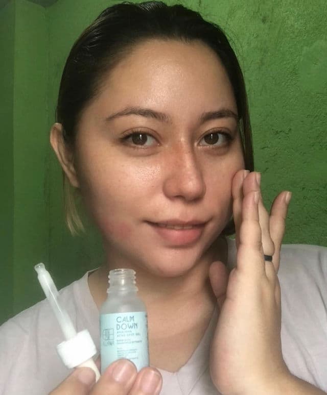 Calm Down AHA/BHA Acne Spot Gel product review