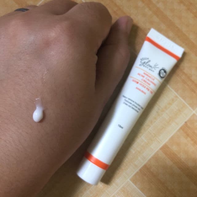 Hello Glow Blemish Miracle Set - Cream review photo by Yssaaa