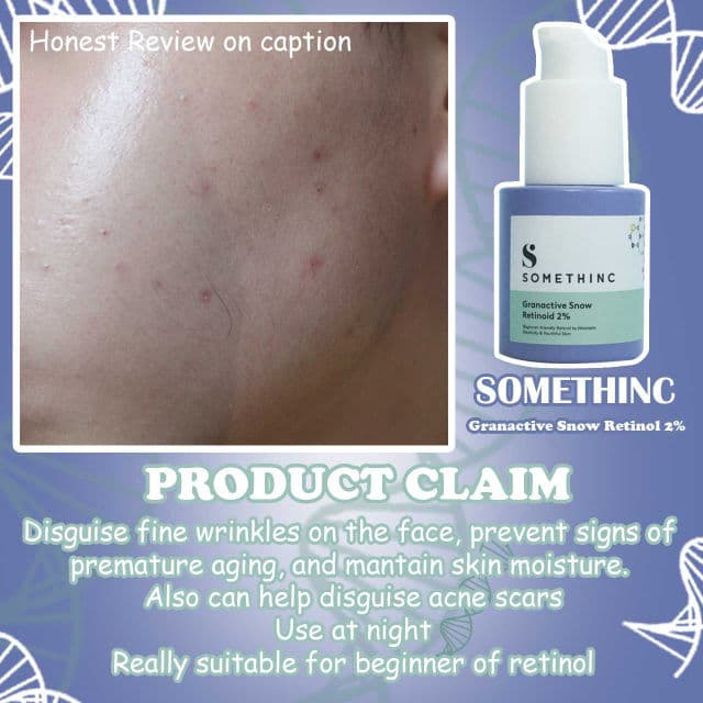 Somethinc Granactive Snow Retinoid 2% review photo by ALPINOprananda