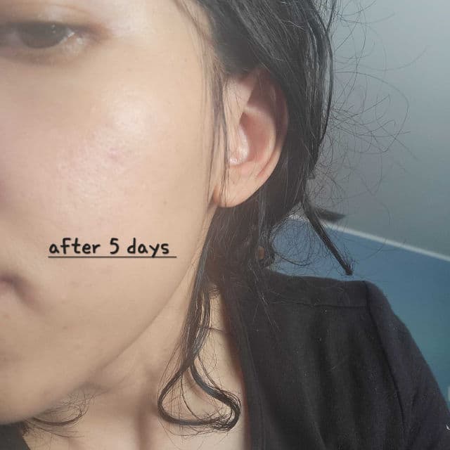 Hero Cosmetics Rescue Balm review photo by tjguida