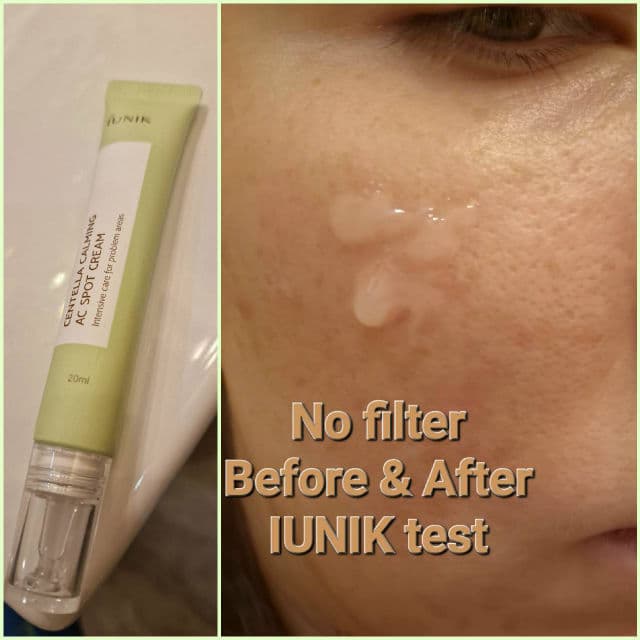 Centella Calming AC Spot Cream product review