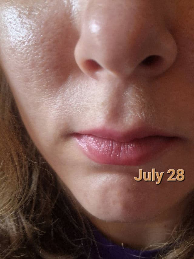 Centella Calming AC Spot Cream product review