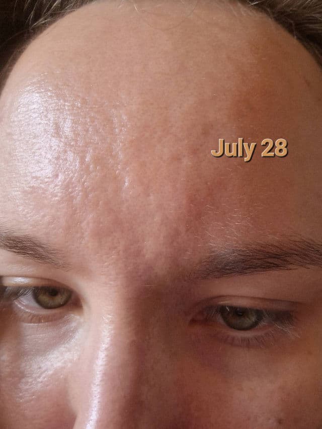 Centella Calming AC Spot Cream product review