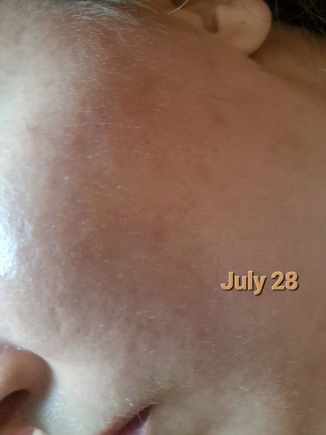 Iunik Centella Calming AC Spot Cream review photo by Immortelle