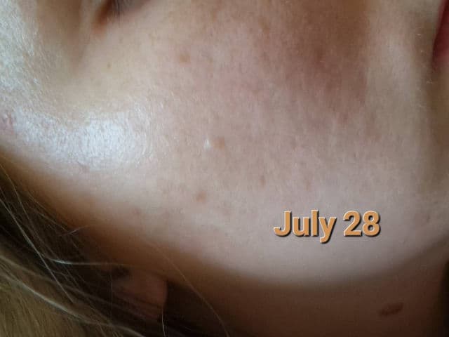 Centella Calming AC Spot Cream product review
