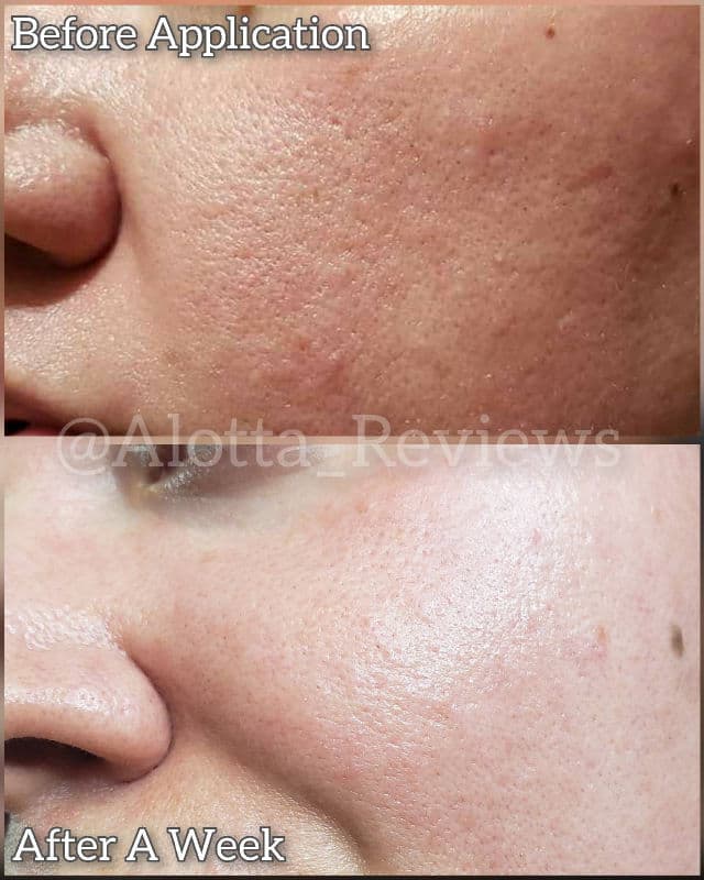Primera Youth Radiance Vitatinol Serum review photo by AlottaxReviews