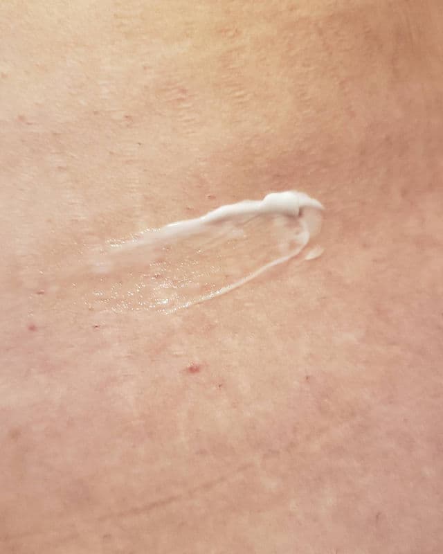 Atopalm Stretch Mark Cream review photo by AlottaxReviews
