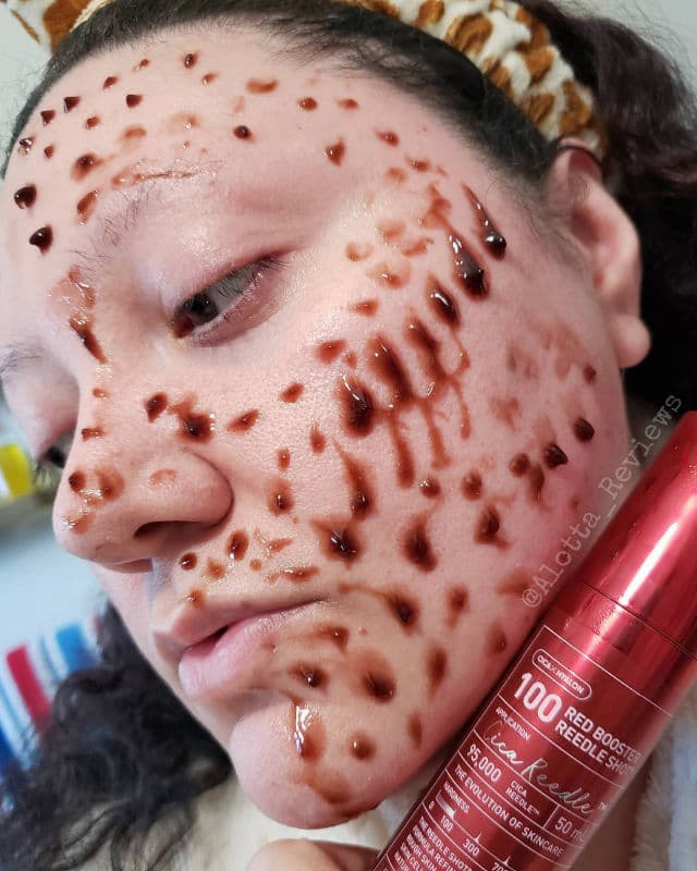 VT COSMETICS Red Booster Reedle Shot 100 review photo by AlottaxReviews