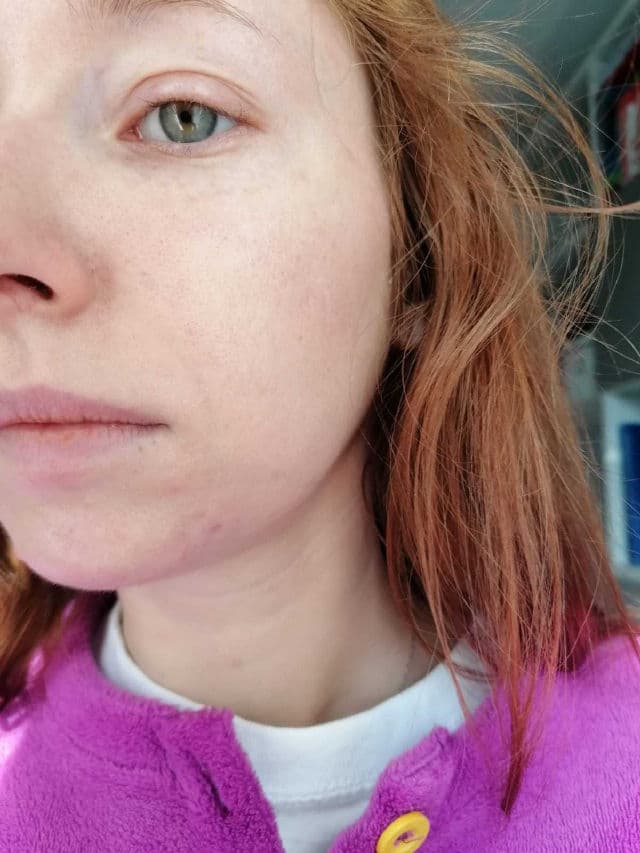 Colibri Cosmetics 2 % BHA Peeling review photo by gretaskincare