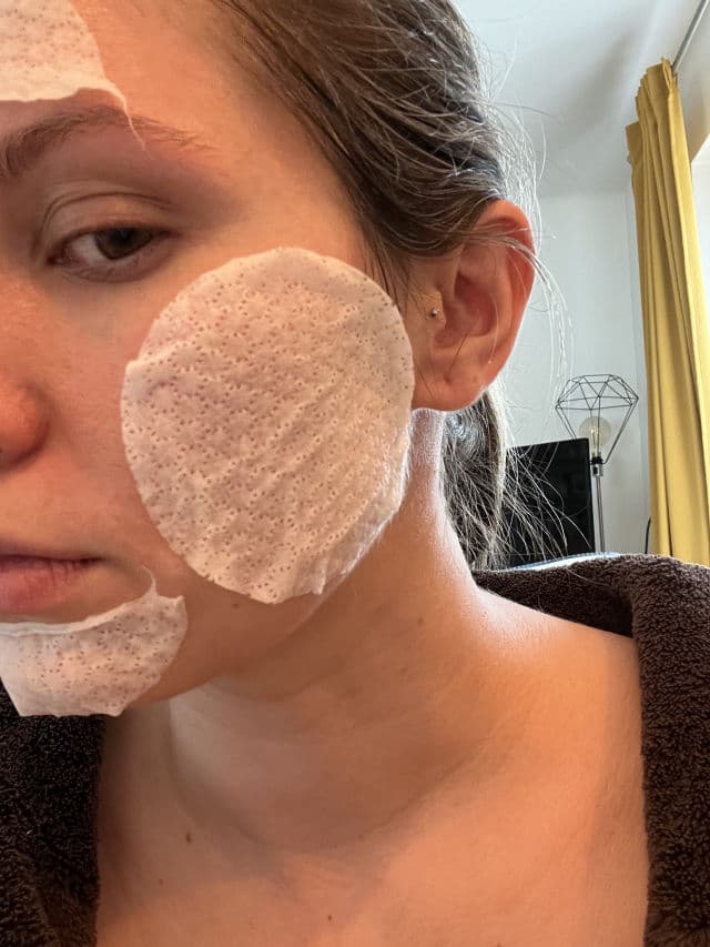 CHICHO Dandelion Radiance Serum Pads review photo by Biucikacska