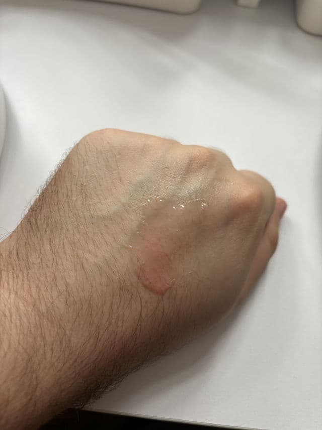 ANUA Niacinamide 10% + TXA 4% Dark Spot Correcting Serum review photo by Dennis