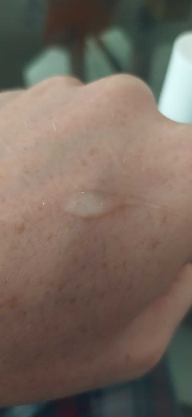Retincare product review