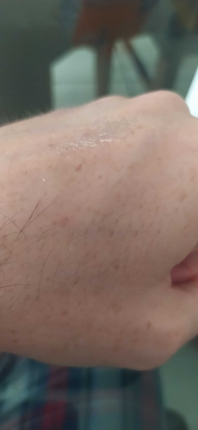 Retincare product review