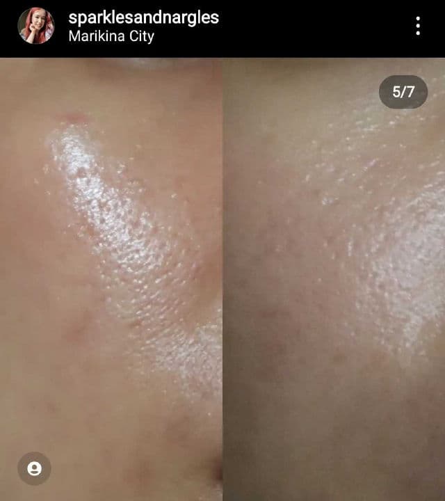 Somethinc Level 1% Encapsulated Retinol review photo by sparklesandnargles