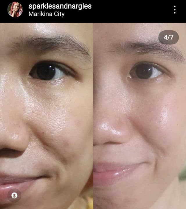 Somethinc Level 1% Encapsulated Retinol review photo by sparklesandnargles