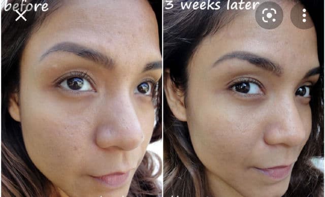 Clarins Double Serum Eye review photo by EastCoastLiving