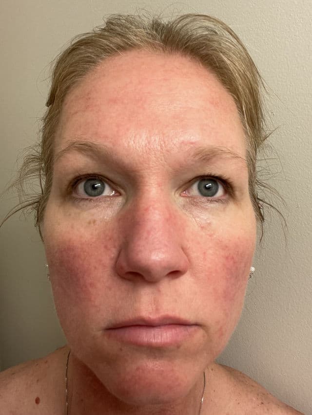 Thayers Witch Hazel Aloe Vera Formula Rose Petal review photo by youbyou