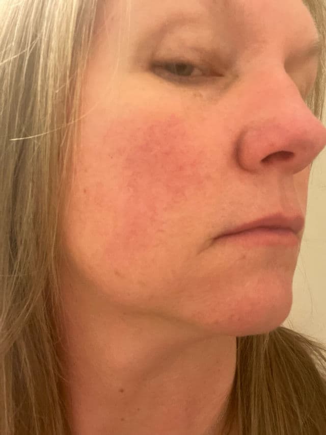 Perricone MD No Makeup Instant Blur Priming Moisturizer review photo by youbyou
