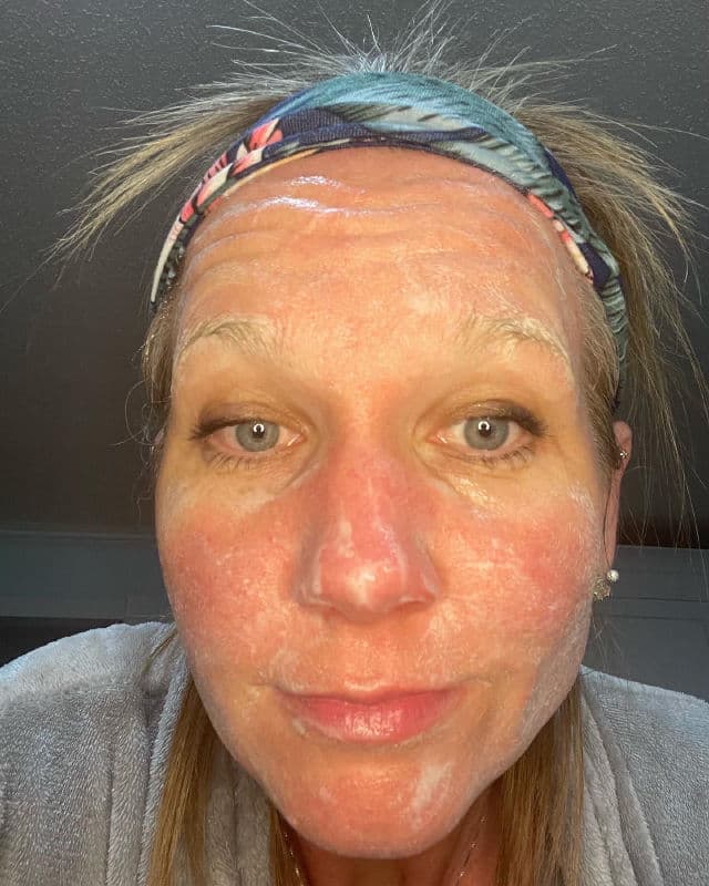 GLOWBIOTICS Probiotic Revitalizing Cleanser review photo by youbyou