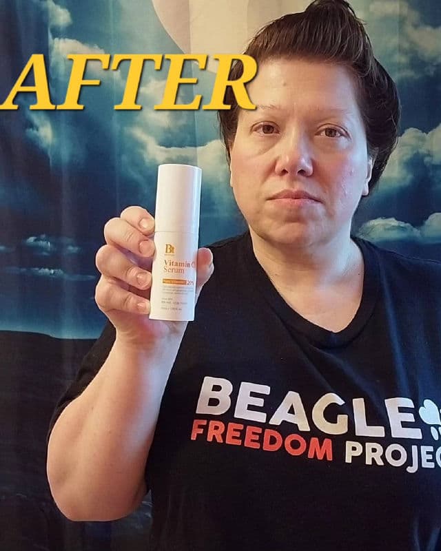 BENTON Vitamin C Serum review photo by BurgundySpider