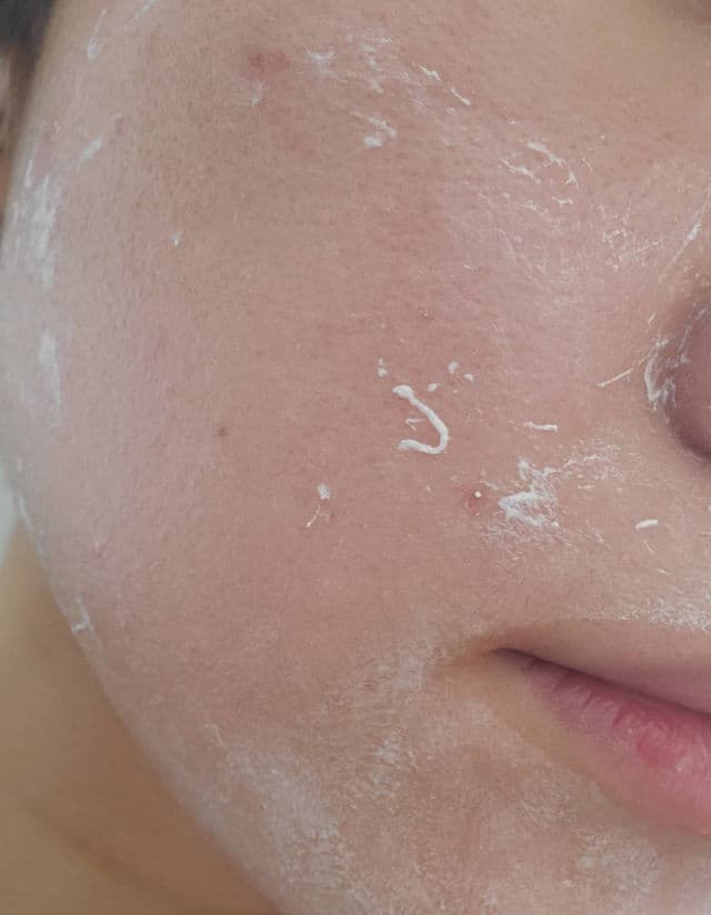 SKIN1004 Madagascar Centella Tea-Trica B5 Cream review photo by hhhhhhhhhhh