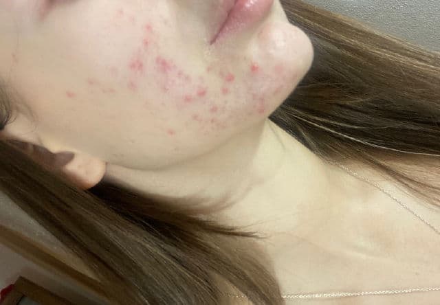 Medik8 Surface Radiance Cleanse review photo by AndriK