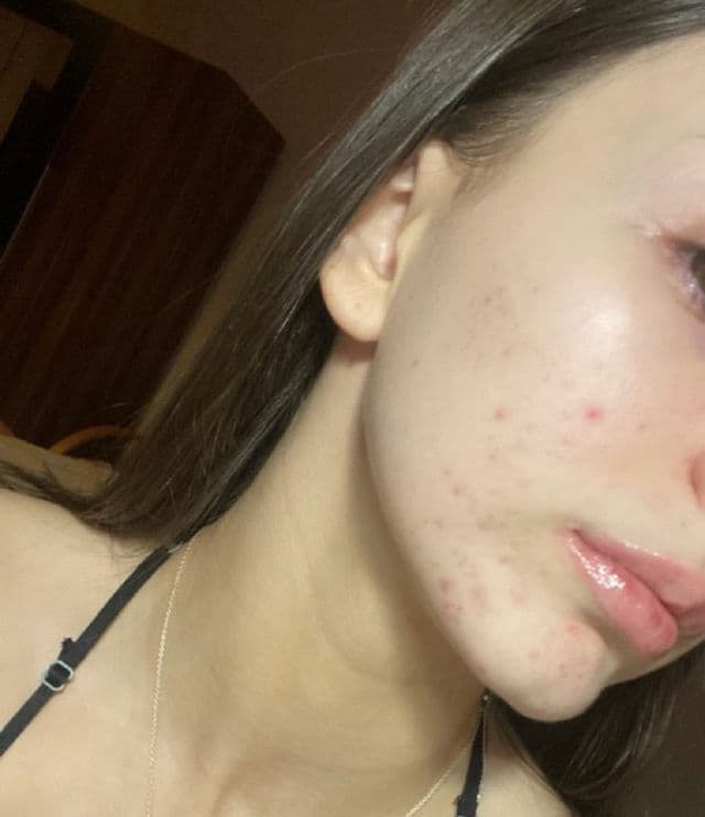 Medik8 Surface Radiance Cleanse review photo by AndriK