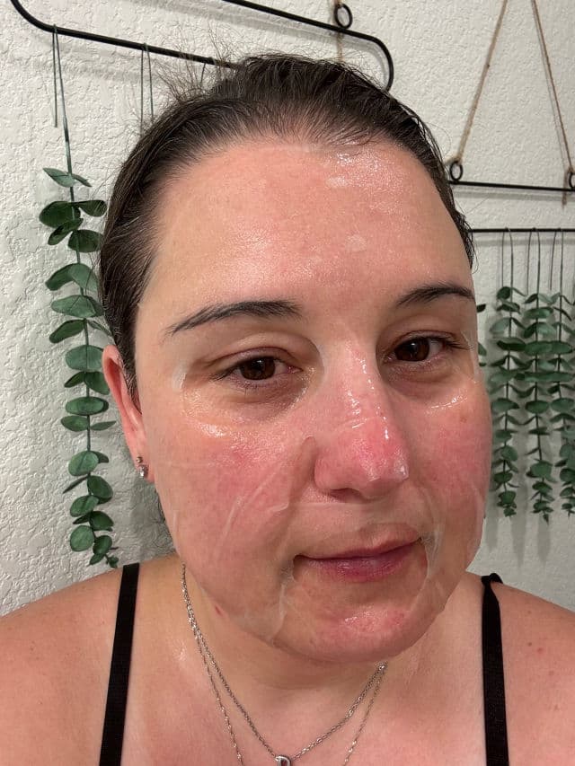 Rovectin [Discontinued] Lotus Water Calming Sheet Mask review photo by DanielleSkin27
