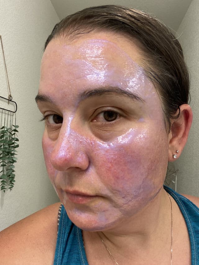 Paula's Choice SKIN PERFECTING 25% AHA + 2% BHA Exfoliant Peel review photo by DanielleSkin27