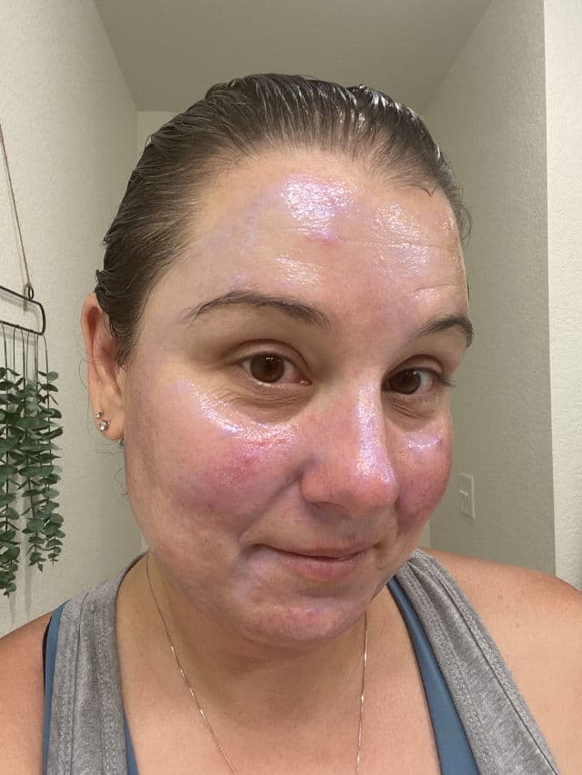 Paula's Choice SKIN PERFECTING 25% AHA + 2% BHA Exfoliant Peel review photo by DanielleSkin27