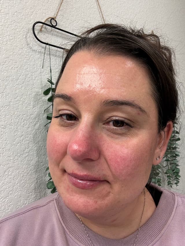 Naturium Lychee review photo by DanielleSkin27