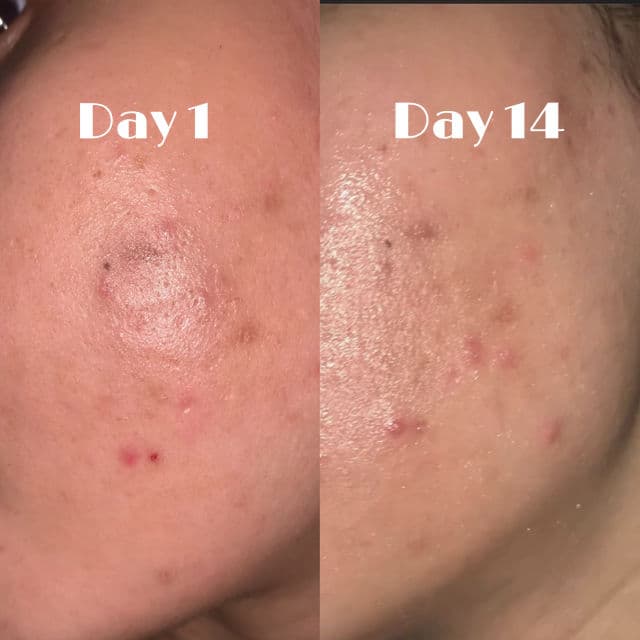 Pyunkang Yul Calming Deep Moisture Toner review photo by Myskinappetite