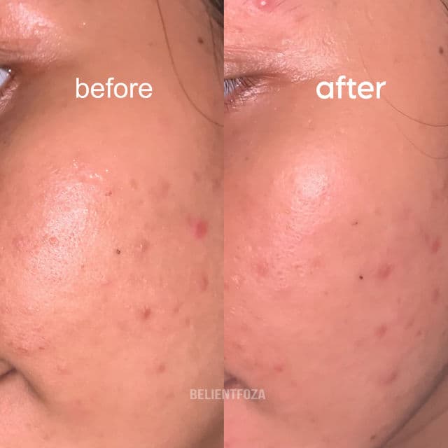 ACWELL Licorice pH Balancing Advance Serum review photo by Myskinappetite