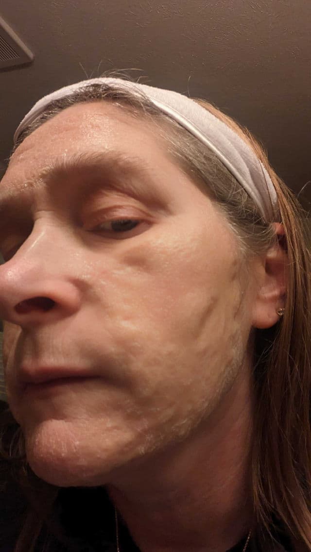 ZOMBIE BEAUTY by SKIN1004 Zombie Pack product review