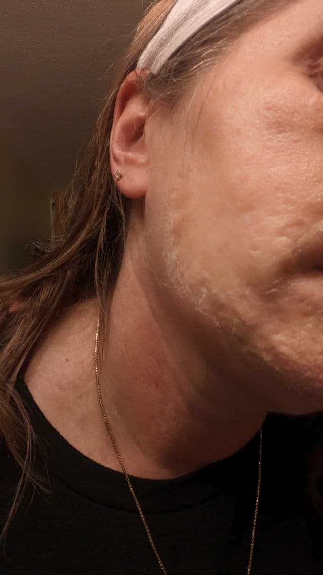 ZOMBIE BEAUTY by SKIN1004 Zombie Pack product review