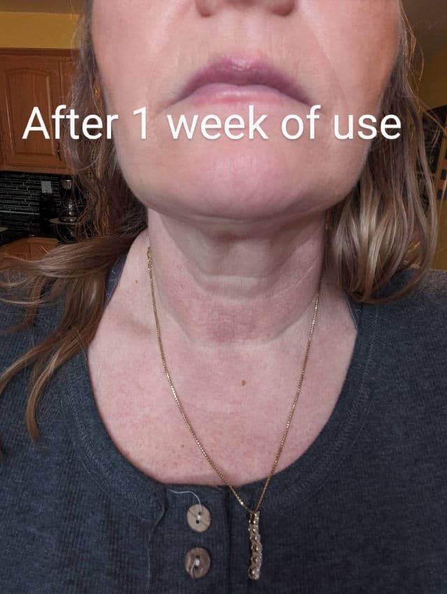 Dr. Brandt Needles No More Neck Sculpting Cream review photo by SandraG