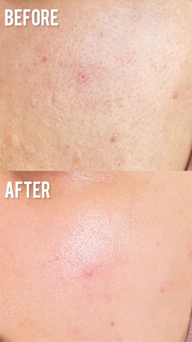 HaruHaru WONDER Centella 5% Niacinamide Radiance Gel Cream review photo by skincare12
